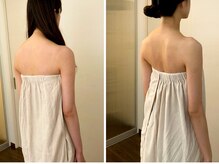 アマリエ/before after