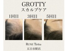 ルネティルタ 五日市駅前店(RUNE Tirtha)/スカルプケア