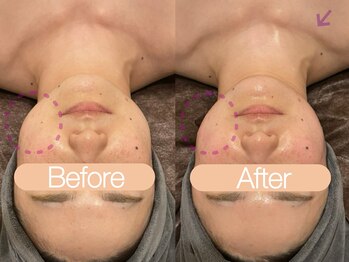 クレヴィア バイ サイバーエステ(CREBIA)/左右非対称にお悩みの方★コルギ