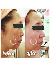 ヴィーナスハート/☆しみケア☆