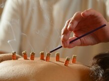 アクアの雰囲気(お身体の症状に合わせた鍼灸施術でのケア)