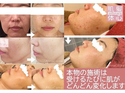 アンナカルナ(AnnaCarna)の写真