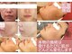 アンナカルナ(AnnaCarna)の写真