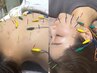 【肩こり/腰痛/疲労】身体も顔も整う◎うつ伏せ治療鍼+美容鍼＋オイル90分