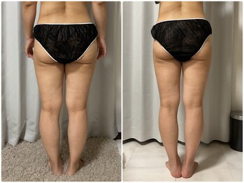 美 プラス(美 Plus)/【美脚プログラム】