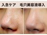 スタッフオススメ【毛穴引き締め】黒ずみケア&高濃度美容液イオン導入&マスク