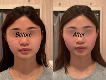 薬手名家 心斎橋店/お客様ビフォーアフター