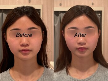 薬手名家 心斎橋店/お客様ビフォーアフター