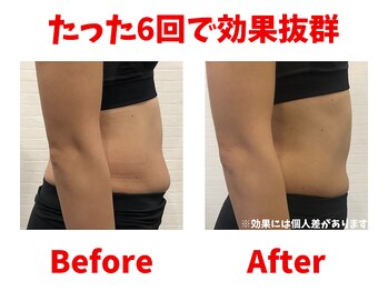 ブティックヒットスタジオ ルアナ(Boutique HIIT Studio LUANA)/短時間集中で驚きの効果♪