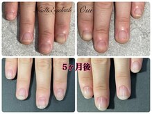 ウイ(Oui)/深爪育成