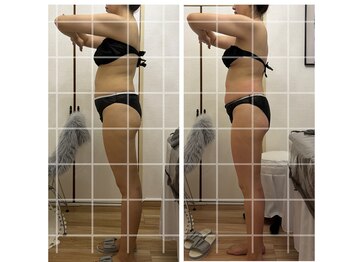 リア(Lia)/ビフォーアフター画像