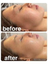 ギンザアール(GINZA R.)/小顔美人に♪