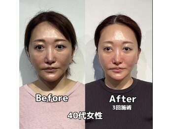 コルミチョン サロン(骨美整 salon)/40代女性　Before・After