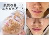 【しつこいニキビにお悩みの方へ】剥離なしハーブピーリング　40分