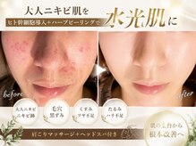 マリエンドリー