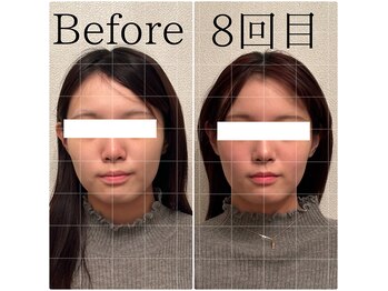 リリールーチェ(Lily luce)