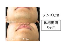 メンズビオ 神戸三宮店/