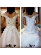 パルフェット(parfaite)/全身どこでもハイパーナイフで