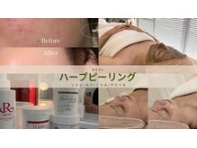 アルテ 神戸(Arte)