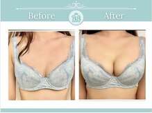 美人バスト 岡山店の雰囲気（効果◎ふっくら、うっとりバストを叶えます★ バストアップ/育乳）