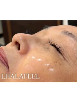 ハリツヤをUPしたい