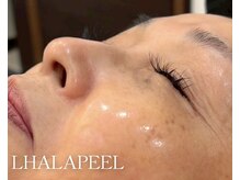 アイオンラッシュ(Aion Lash)