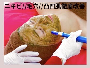 サロン ド シェリー/ニキビケア/凸凹肌/毛穴/改善