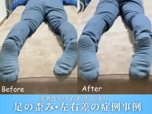 整体院ワト 蒲田院(WATO)/■歪み・左右差の症例事例