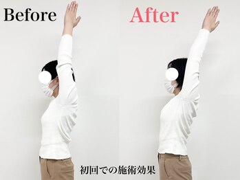 寿 上野院(KOTOBUKI)/整体/上野/肩こり/上野整体