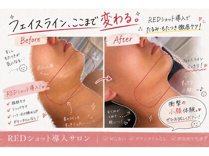 リンパセラピーファシル(Facile)の写真