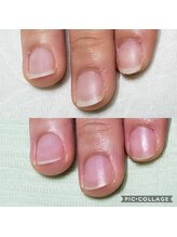 トイロネイルズ(toiro-nails)/