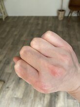 ナノハナ/鹿沼市の全身脱毛のナノハナ