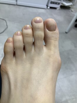 ロンディネ(Rondine)の写真/[プロによる本気のフットケア]パンプスを履くと痛い,匂いが気になる,爪がもろい…など様々なお悩みに対応◎