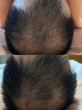 リラクゼーションの森/