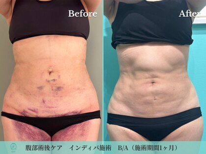 ノット(KNOT)の写真