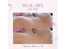 ホワイトセージ(White Sage)/ビフォーアフター