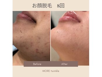 モアトゥインクル 福山宮通り店(MORE twinkle)