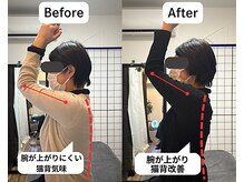 整体院 爽良/【札幌/大通り】猫背矯正