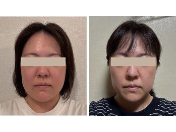 晴れ晴れ整体院/小顔になりたい方!必見