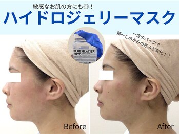 サロンイーエフ セントラル店(Salon EF)/ハイドロジェリーマスクパック