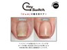 【7月限定★巻き爪ケア】ヘイスイッチ巻き爪ケア+フットネイル¥6,080