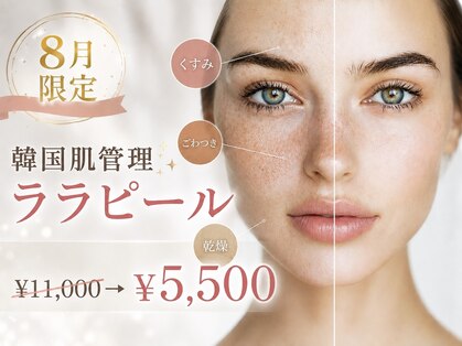 ベラピエル(BELLA Piel)の写真