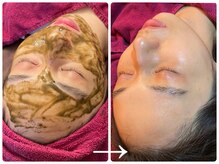 フォーチューン/和漢ハーブトリートメント