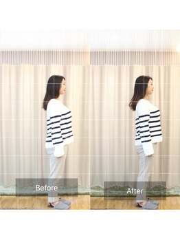 サンテ(Sante)/和整体施術前後