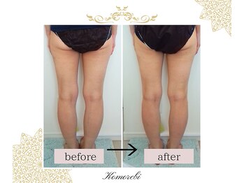 コモレビ(Komorebi)/