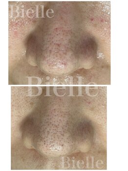 ビエル(Bielle)/つまった毛穴をクリーンに！