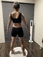 3D測定分析機を使い、オーダーメイドの痩身をご提案