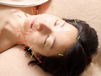 トナリ鍼灸院/【肩こり・小顔】美容鍼120min