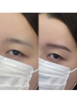 チルアンドアイ 千葉駅前店(Chill&Eye)/美眉スタイリング/BeforeAfter