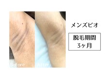 メンズビオ 神戸三宮店/